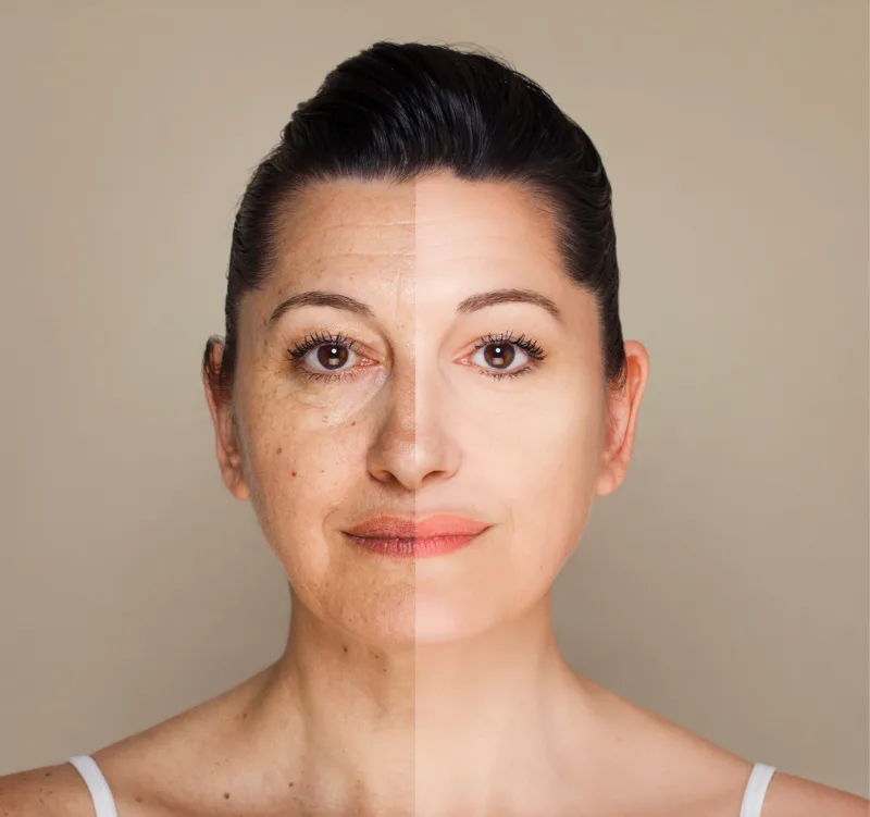 Before and after NAD+ IV Therapy - Vigeo Care Center & Aesthetics in Algonquin Il