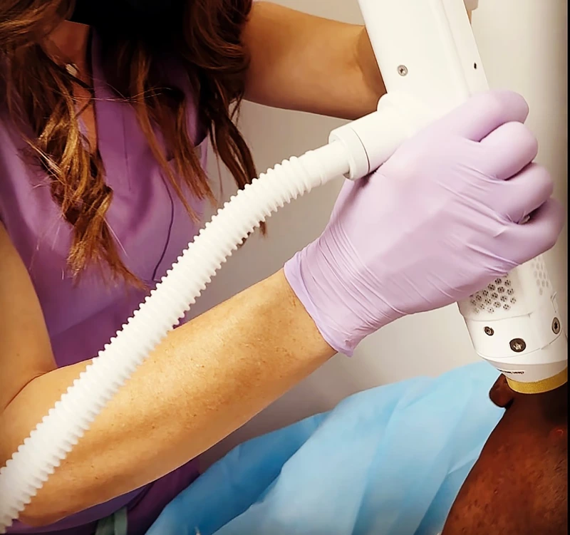 Benefits of Aerolase Scars & Stretch Marks (Striae) Treatment - Vigeo Care Center & Aesthetics In Algonquin IL